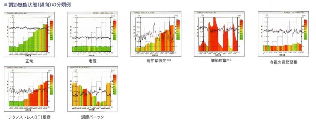 眼精疲労 疲れ目 の専門的な検査治療 岡山市北区眼科クリニック コバヤシ眼科 岡山市北区の一般 小児眼科クリニック ドライアイ等 コバヤシ眼科